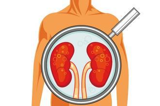 Biosynex Kidney Function Related Rapid Diagnostic Products (Colloidal Gold Method)